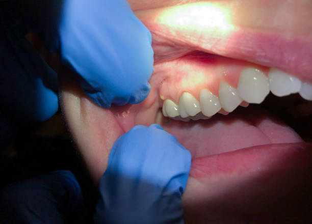 Best Tooth Infection Emergency Dentist  in Cabot, AR